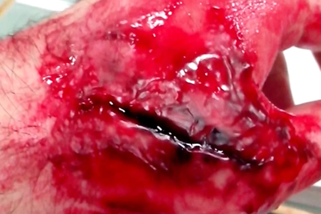Detalhe de ferimento em maquiagem de efeito, com corte aberto e sangue cênico